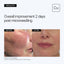 Neova CU3 Tissue Repair