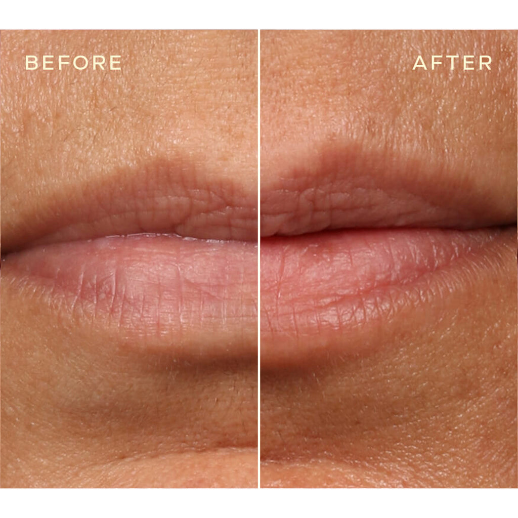 Ourself Replenishing Lip Filler Refill
