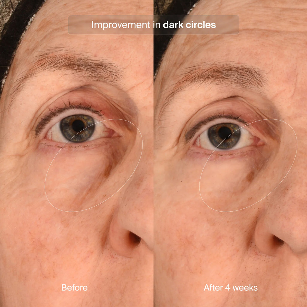 Pavise Precision Eye Lift