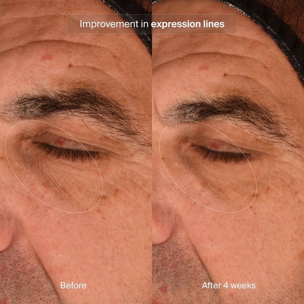 Pavise Precision Eye Lift