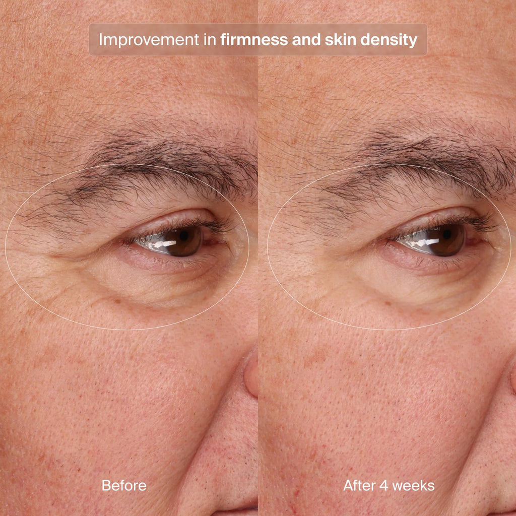 Pavise Precision Eye Lift