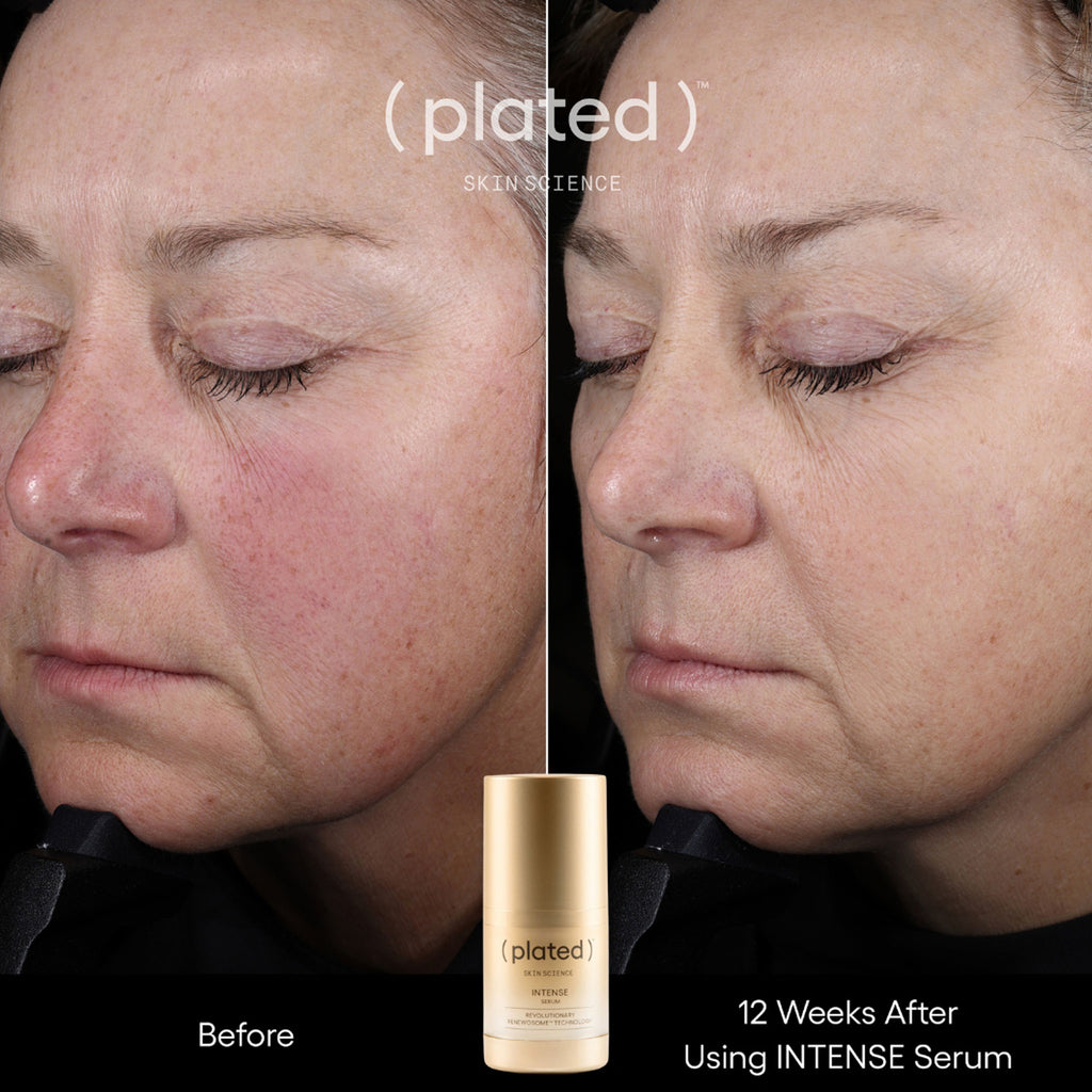 (plated)™ INTENSE Serum