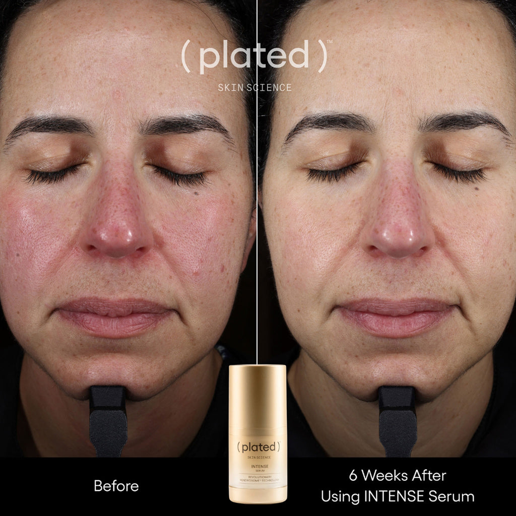 (plated)™ INTENSE Serum